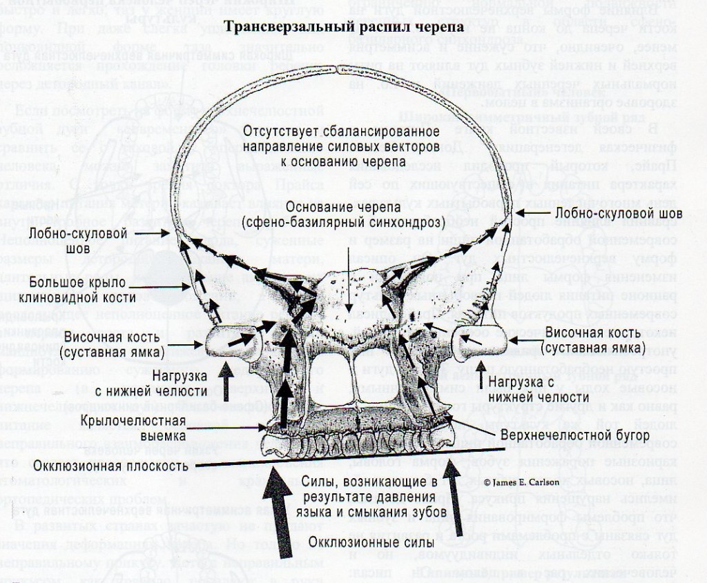 Усиление сосудистого рисунка черепа что значит